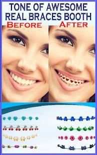 Braces Teeth Photo Maker screenshot 4