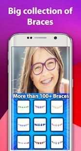 Braces 2018 screenshot 2