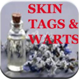 Remove Skin Tags & Warts