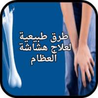 طرق طبيعية لعلاج هشاشة العظام on 9Apps