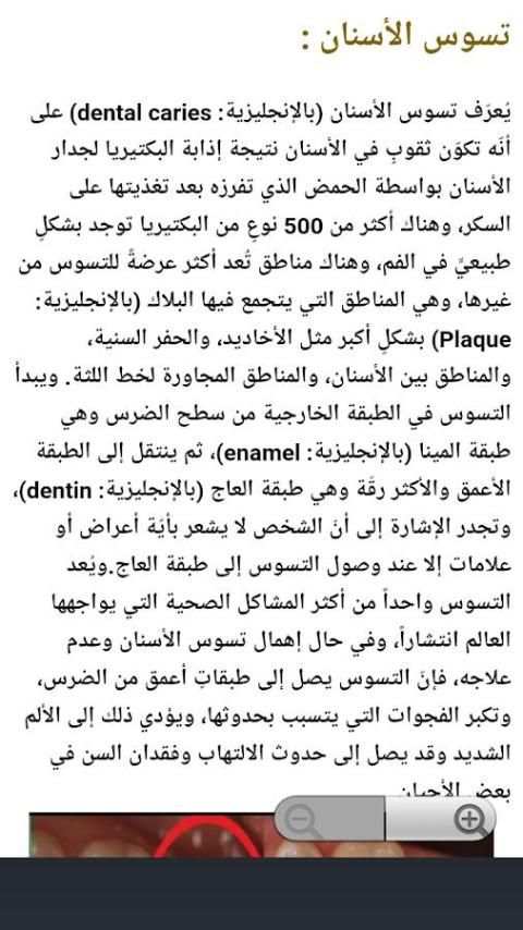 تخلص من تسوس الأسنان في يوم واحد screenshot 1