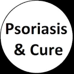 Psoriasis&Cure