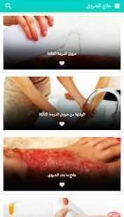 علاج الحروق
‎ screenshot 3