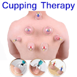 ikon Cupping Therapy