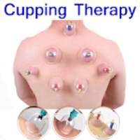 Cupping Therapy