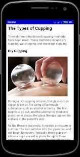 Cupping Therapy screenshot 10