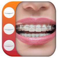 Real Braces teeth Photo Editor