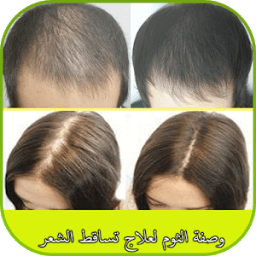 وصفة الثوم لعلاج تساقط الشعر icon