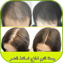 وصفة الثوم لعلاج تساقط الشعر 1.0