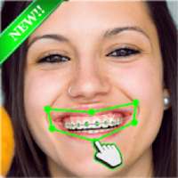 Braces Photo Editor