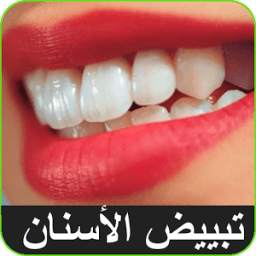 تبييض الاسنان 1.0