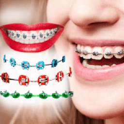 Braces Photo Editor