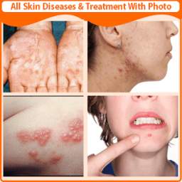 All Skin Diseases and Treatment with photo