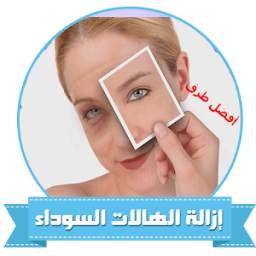ازالة البقع والهالات السوداء 1.5