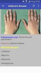 Pathognomonic Sign screenshot 5