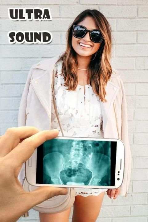 Ultrasound X-ray Scanner Prank स्क्रीनशॉट 4