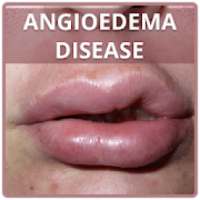 Angioedema Disease on 9Apps