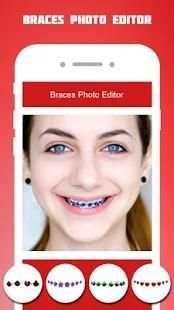 Braces Photo Editor 2018 screenshot 7