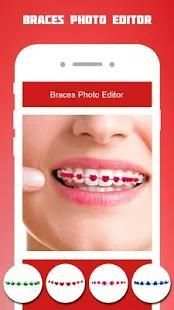 Braces Photo Editor 2018 screenshot 6