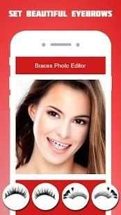 Braces Photo Editor 2018 screenshot 5