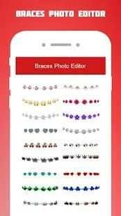 Braces Photo Editor 2018 screenshot 4