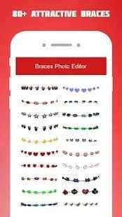 Braces Photo Editor 2018 screenshot 3