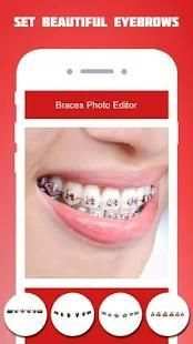 Braces Photo Editor 2018 screenshot 2