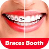 Braces Photo Editor 2018