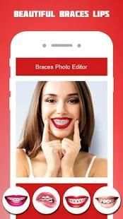 Braces Photo Editor 2018 screenshot 1