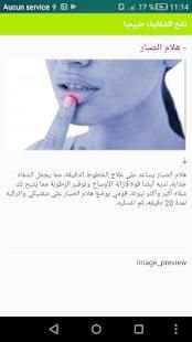 نفخ الشفايف طبيعيا screenshot 1
