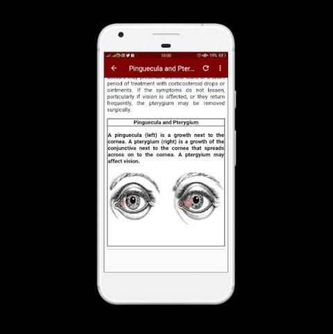 All Eye Disorders screenshot 2