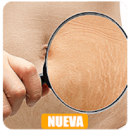 Como Quitar Las Estrías icon