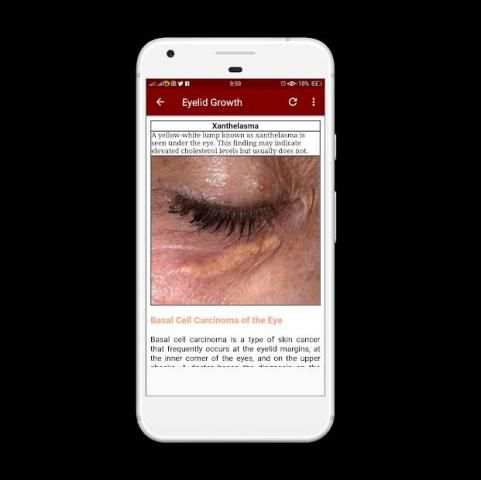 All Eye Disorders screenshot 3