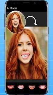 Braces Photo Editor -My Fake Look & Brace Yourself screenshot 2