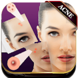 ikon Acne Remover Photo Editor - Pimple remover