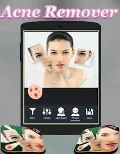 Acne Remover Photo Editor - Pimple remover screenshot 2