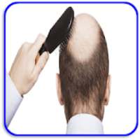 How to Treat Male Pattern Hair Loss on 9Apps