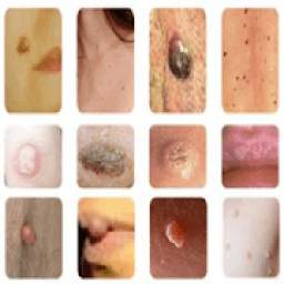 All Common Skin Disorders & Treatments A-Z