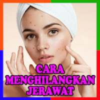 Cara Menghilangkan Jerawat Terbaru