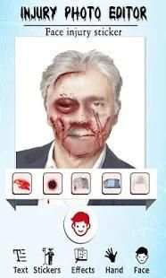 Fake Injuries Photo Editor 2018-Injury Marks Maker screenshot 5