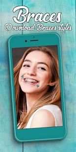 Braces Photo Editor 2018 screenshot 2