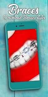 Braces Photo Editor 2018 screenshot 1