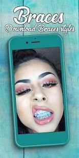 Braces Photo Editor 2018 screenshot 9