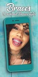 Braces Photo Editor 2018 screenshot 7
