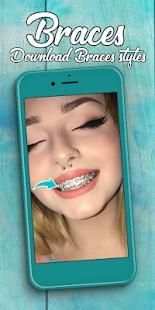 Braces Photo Editor 2018 screenshot 8