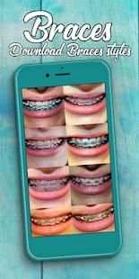 Braces Photo Editor 2018 screenshot 4