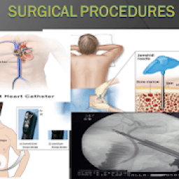 ikon surgical procedures