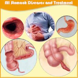All stomach diseases and treatment
