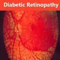 Diabetic Retinopathy (Causes+Remedies) on 9Apps
