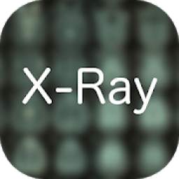 X-Ray Differential Diagnosis